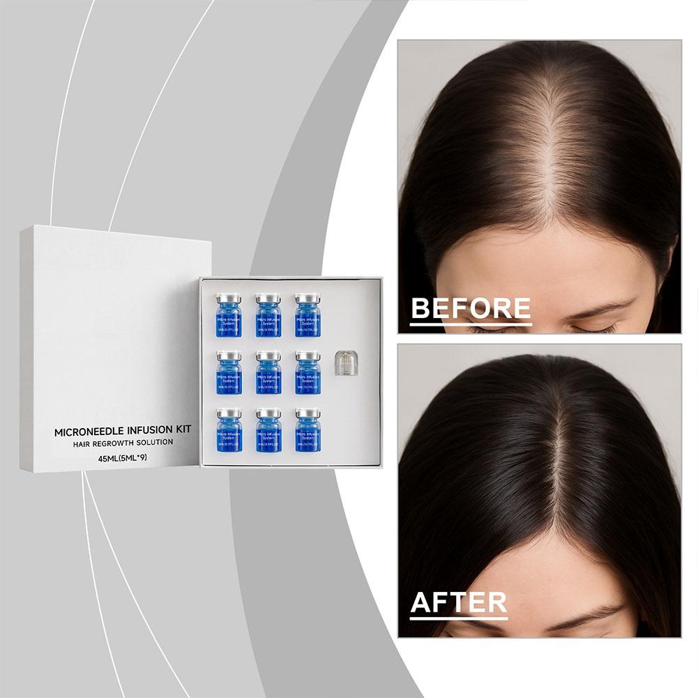Hair Care Essence Oil - 0.25mm Hair Essential Serum Micro-needle Roller