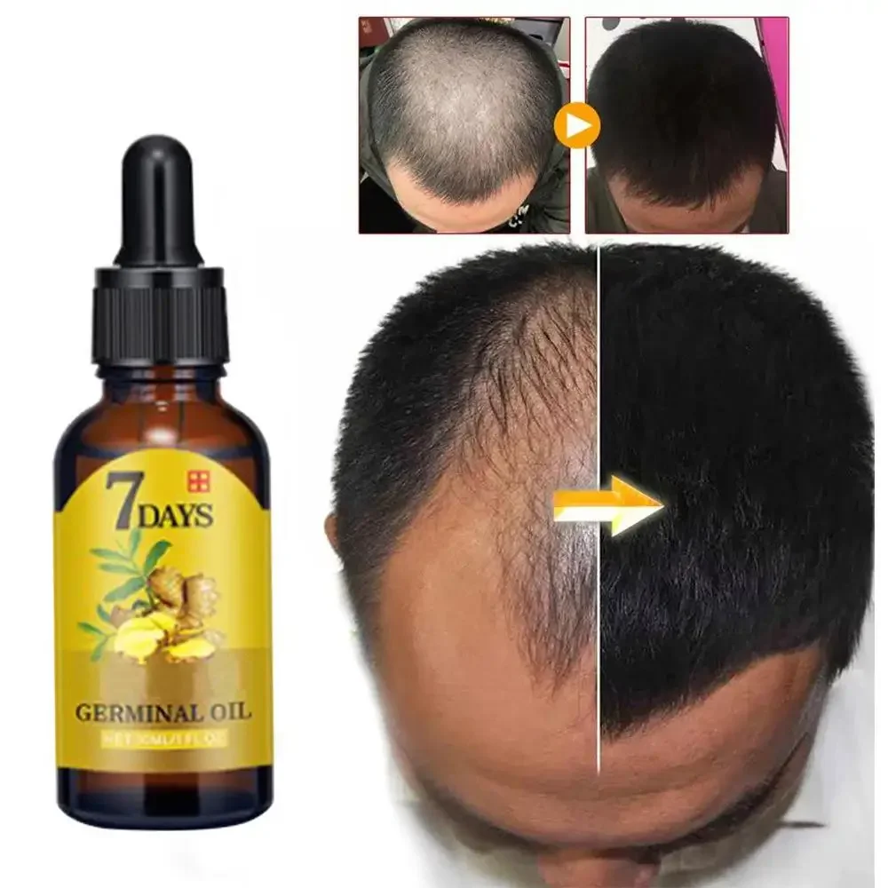Hair Care Essence Oil - Hair Growth Ginger Fast Growing Hair
