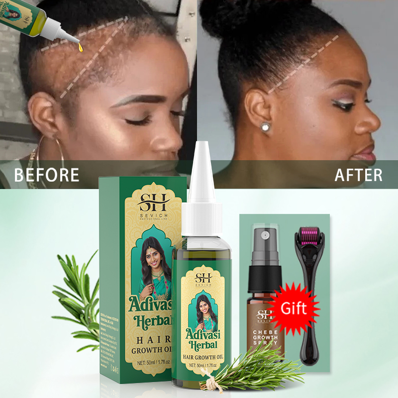 Ayurvedic Hair Growth Oil Indi - đánh giá và giá Hair Care Essence Oil