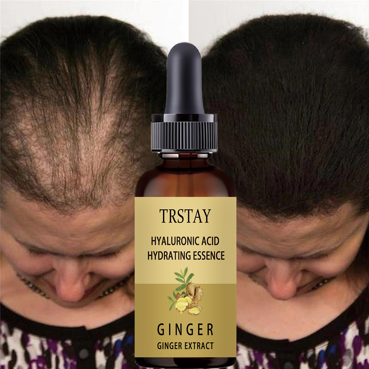 Hair Growth Serum Anti Prevent - đánh giá và giá Hair Care Gisou