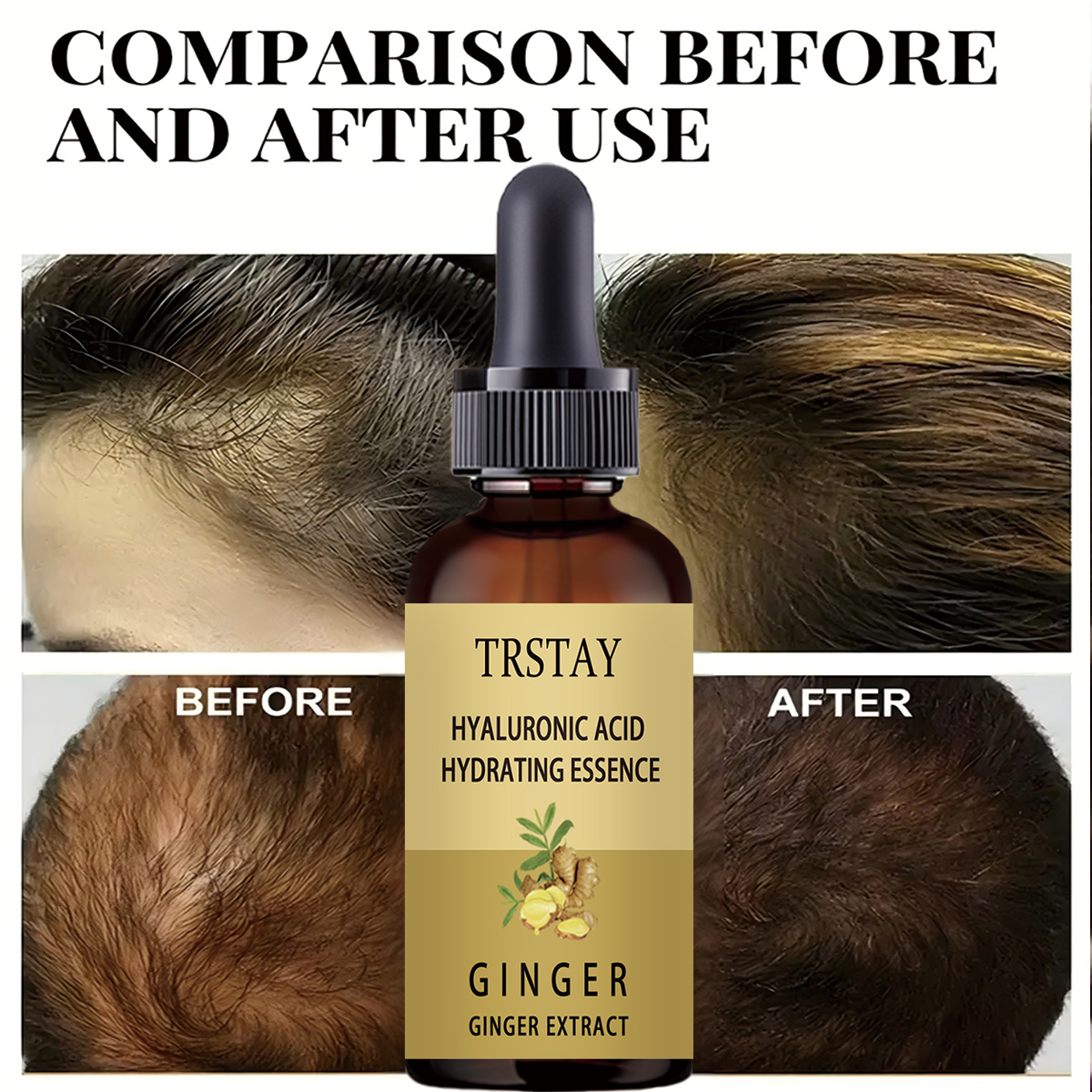 Hair Growth Serum Anti Prevent - đánh giá và giá Hair Care Gisou