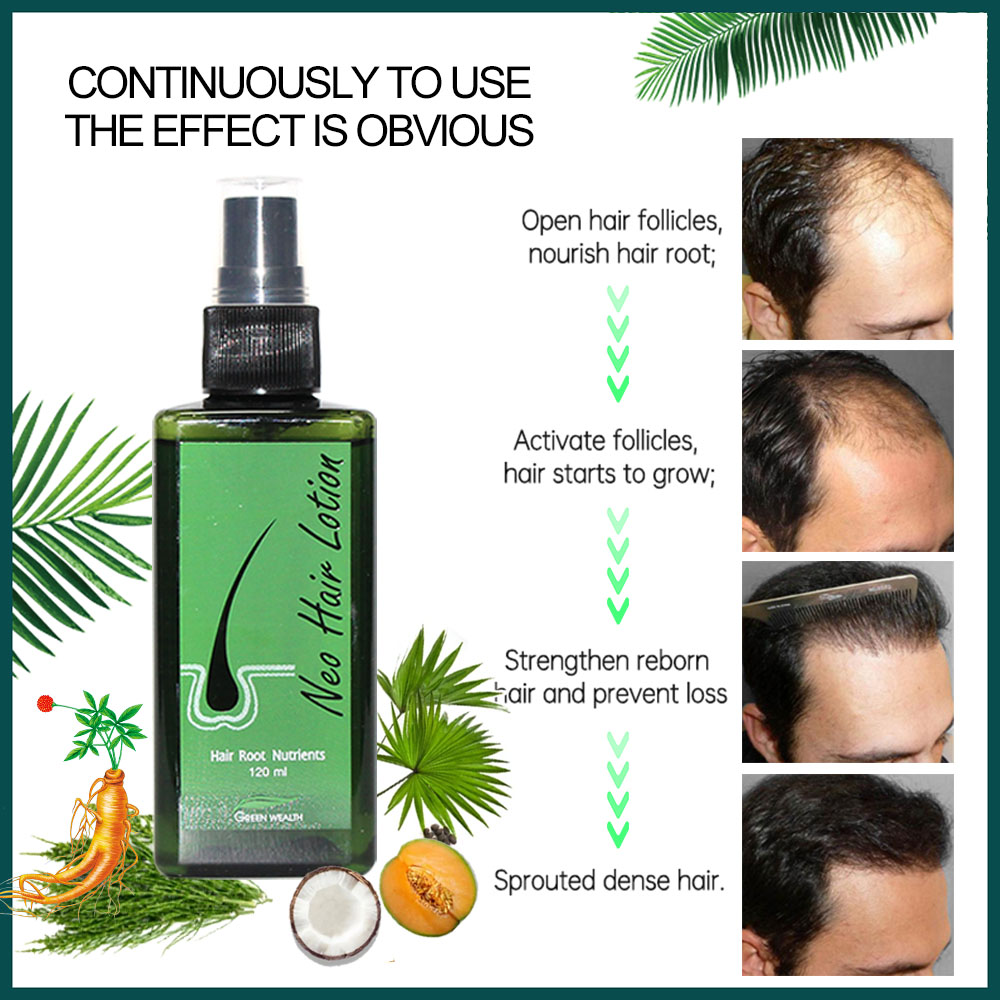 Neo Tóc 120Ml Tóc Điều Trị Tận - đánh giá và giá Hair Care Gisou