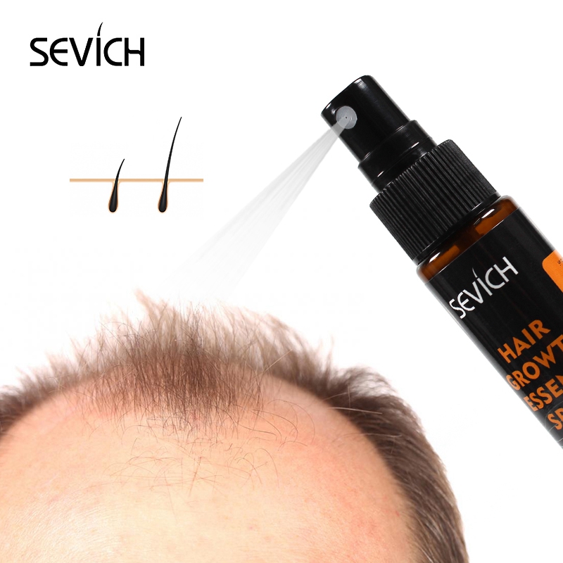 Sevich 30Ml Hebal Tinh Chất Dầ - đánh giá và giá Hair Care Essence Oil