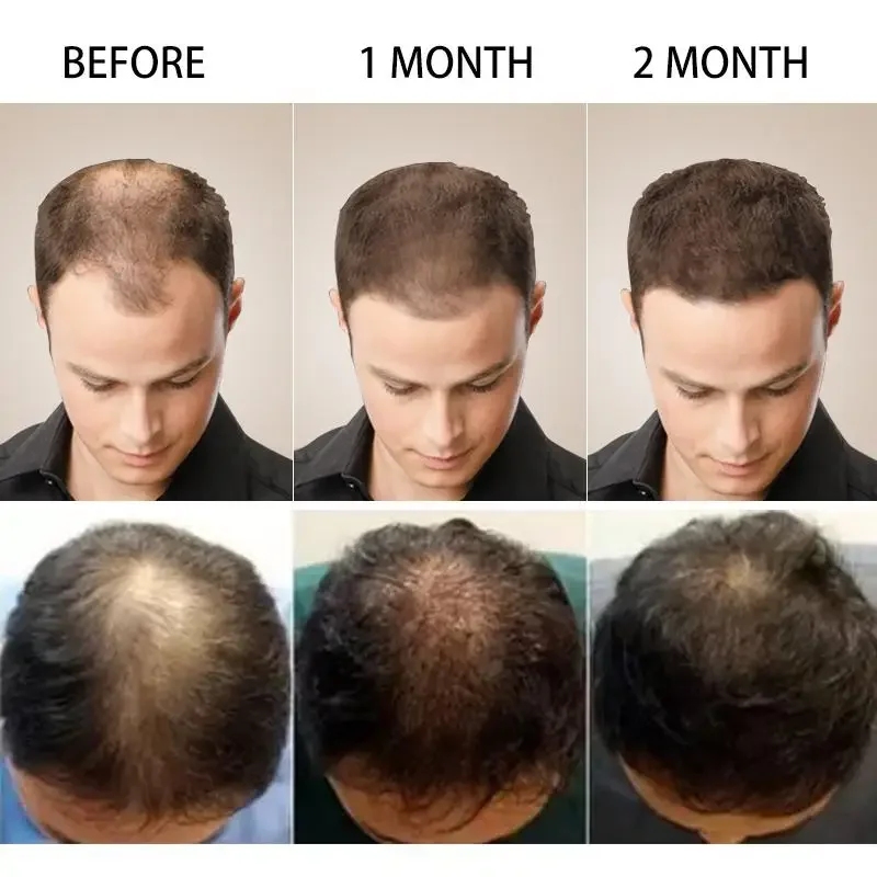 Hair Growth Ginger Fast Growin - đánh giá và giá Hair Care Essence Oil